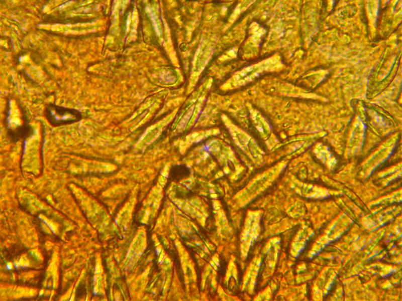 Crosta da determinare (Peniophora incarnata)